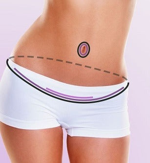 Top 11 Items for a Tummy Tuck Recovery Package and posted Jan 27, 2024