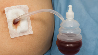 How to Care for Drains After Surgery?