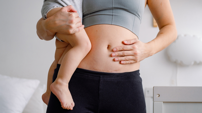 How to Treat Itchy or Painful Scars After Pregnancy-Related Surgery?