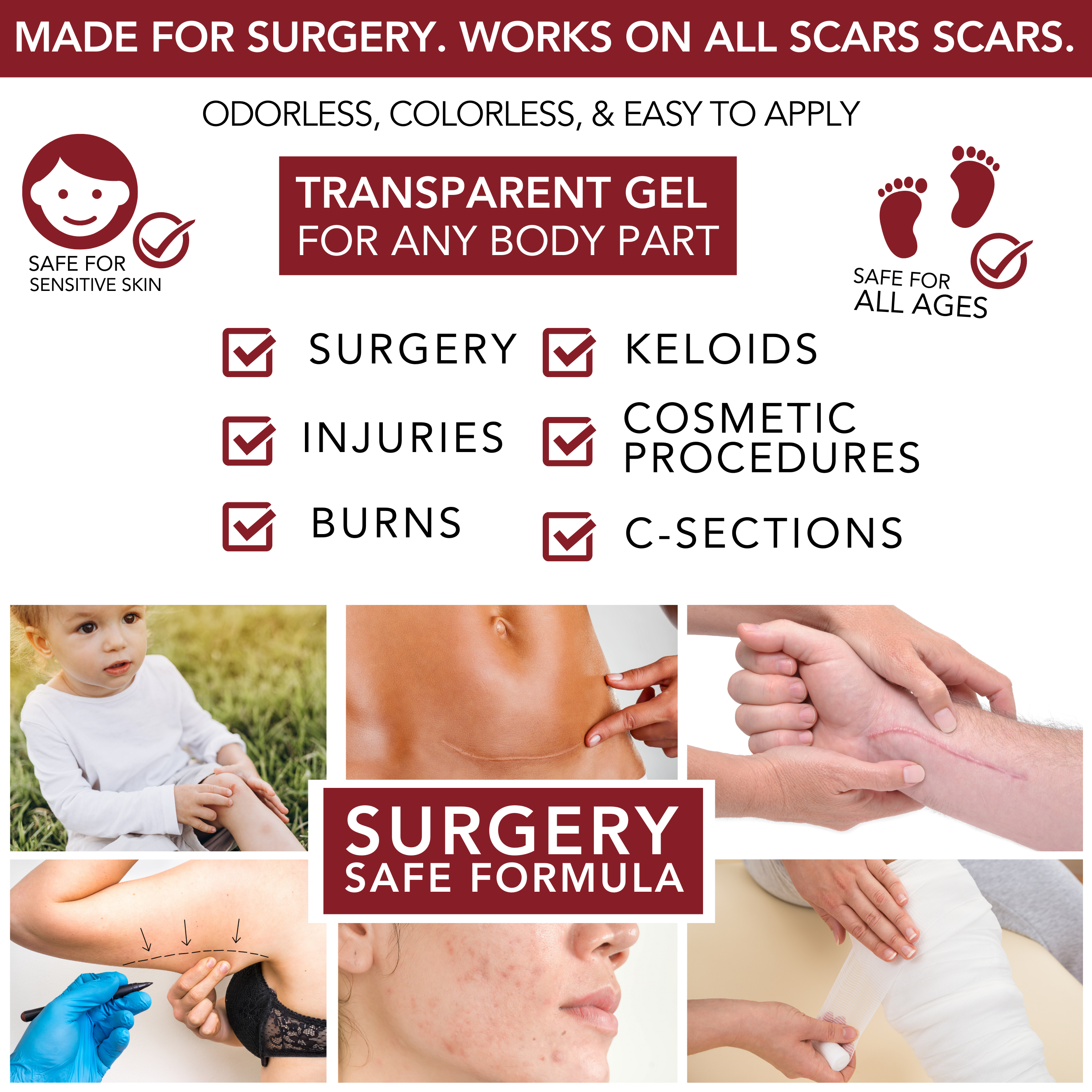Physician Formulated Medical-grade Silicone Scar Gel "Semi-Solid Sheeting"