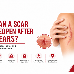 Can a Scar Reopen After Years?