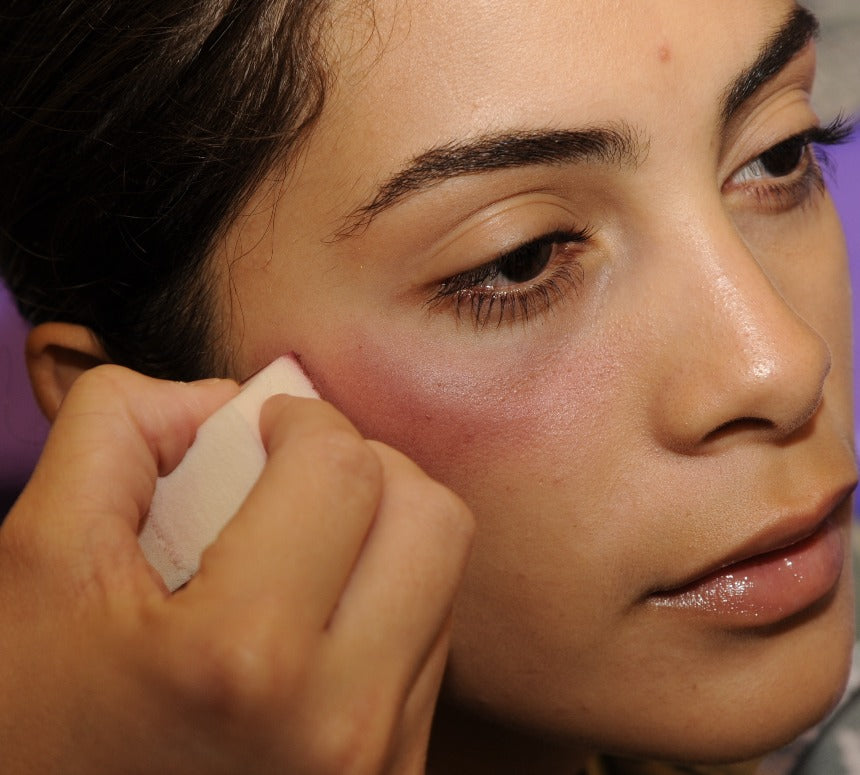Want to prevent bruising after Botox & Fillers?