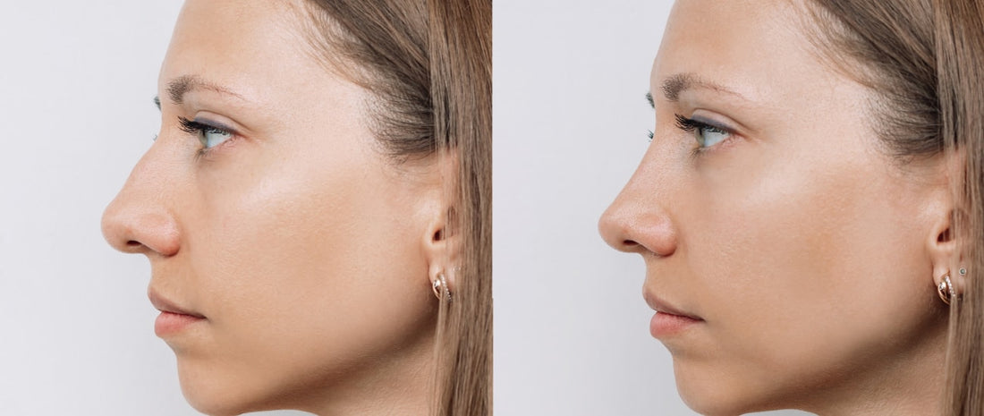 Examining Cosmetic Surgery Before & After Pictures