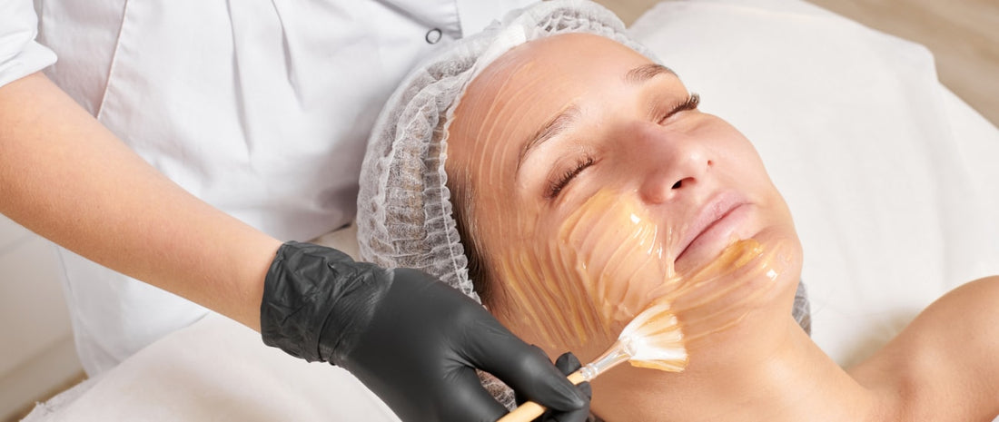 Skin Peels & Exfoliators: The Need To Knows