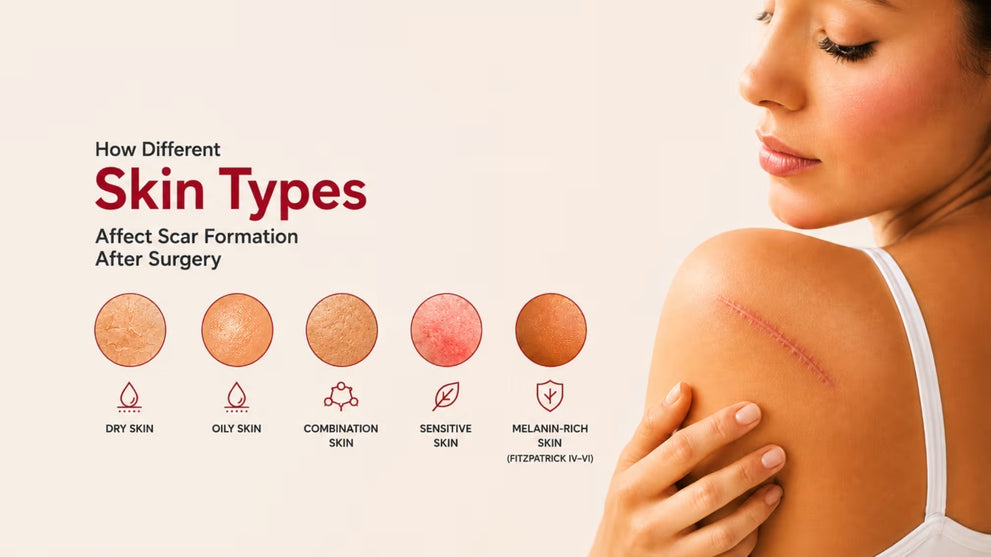 How Different Skin Types Affect Scar Formation After Surgery