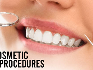 Popular Cosmetic Dentistry Procedures