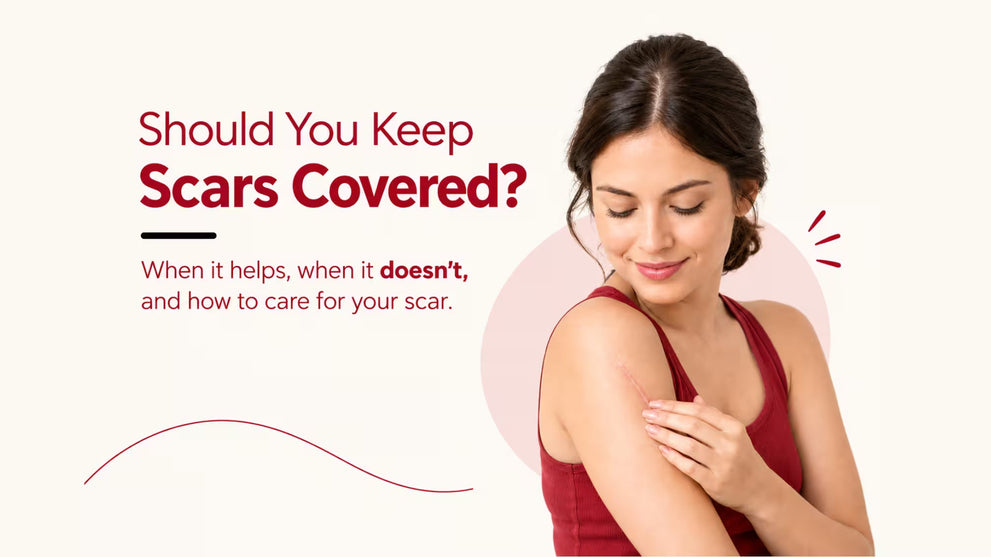 Should you keep scars covered