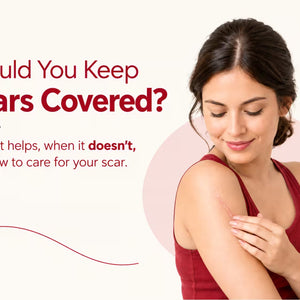 Should You Keep Scars Covered?