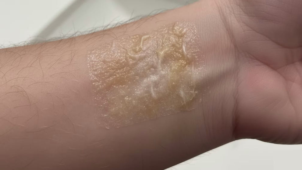 How to Remove Silicone Scar Tape Residue Without Irritating Healing Skin?