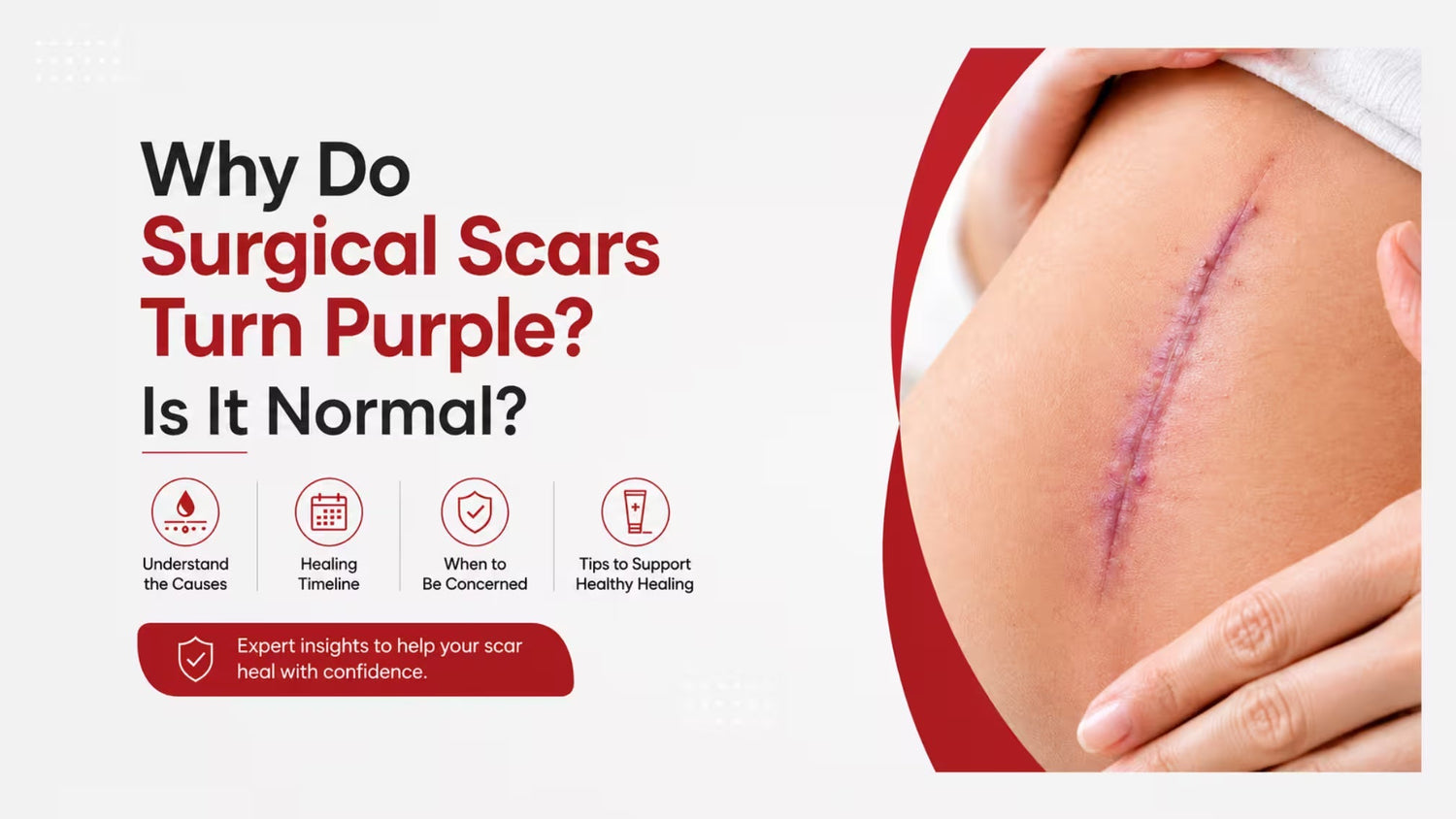 Why Do Surgical Scars Turn Purple? Is It Normal?