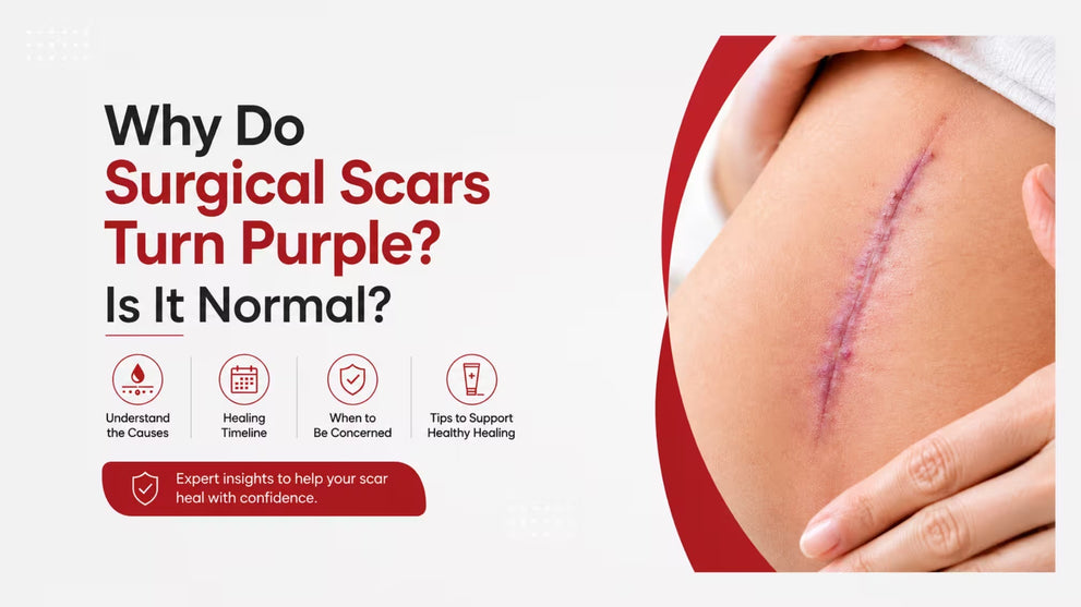 Why Do Surgical Scars Turn Purple? Is It Normal?