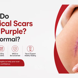 Why Do Surgical Scars Turn Purple? Is It Normal?