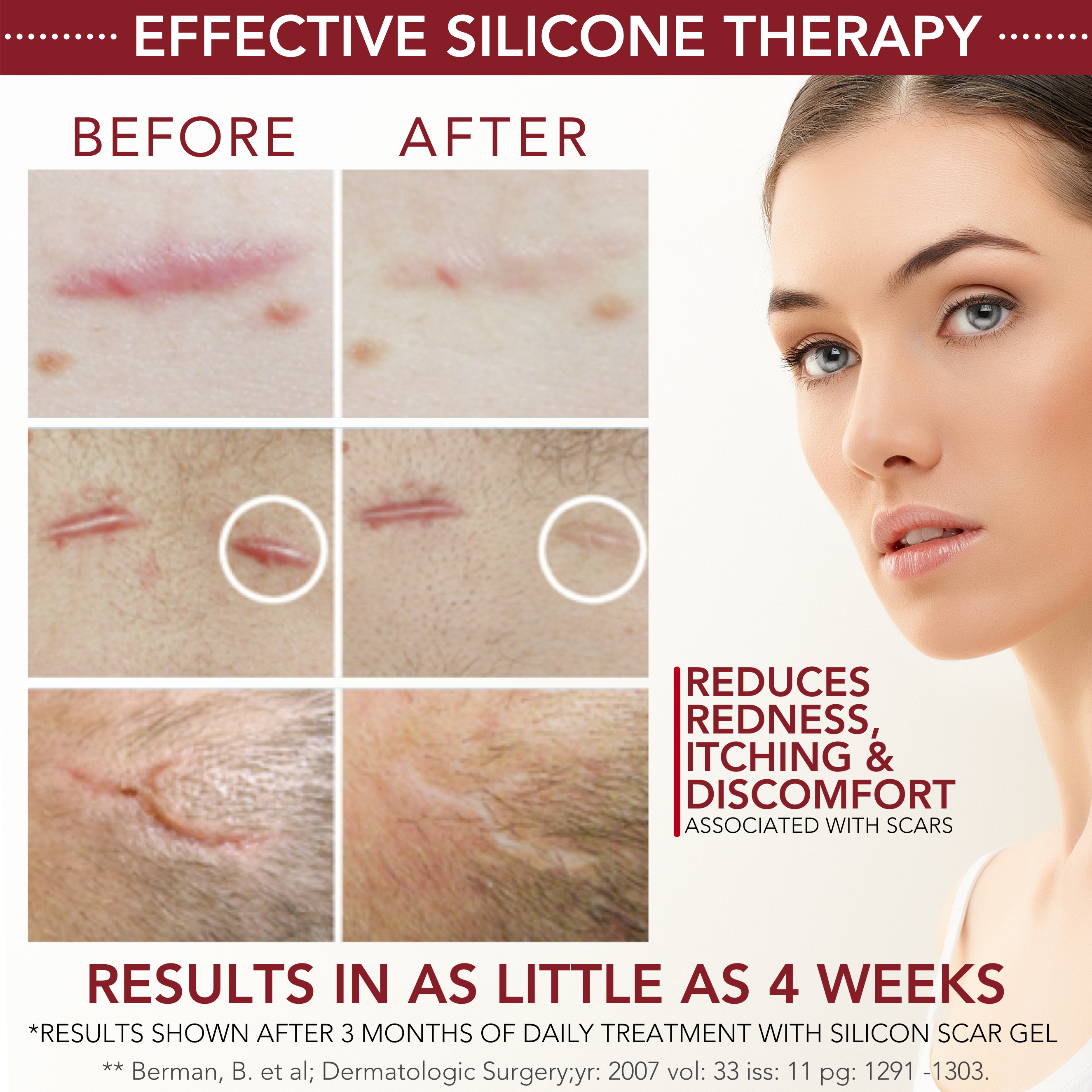 Physician Formulated Medical-grade Silicone Scar Gel - Everest Only